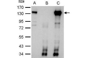IP Image CIZ1 antibody immunoprecipitates CIZ1 protein in IP experiments. (CIZ1 antibody)