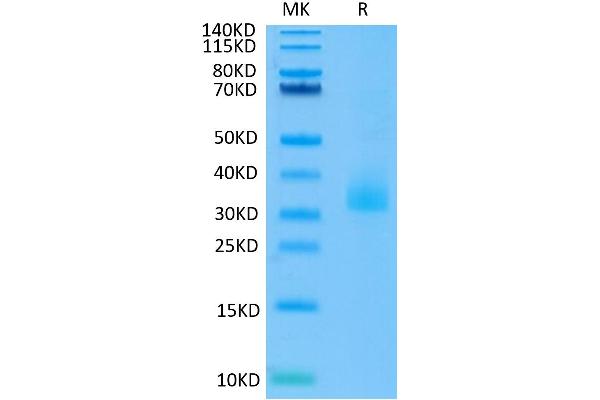 ANGPTL3 Protein (AA 17-219) (His-Avi Tag)