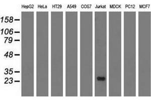 Western blot analysis of extracts (35 µg) from 9 different cell lines by using anti-RIT2 monoclonal antibody. (RIT2 antibody)