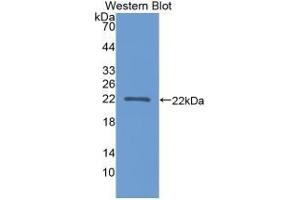 Detection of recombinant APOA1BP using Polyclonal Antibody to Apolipoprotein A1 Binding Protein (APOA1BP) (APOA1BP antibody  (AA 118-282))