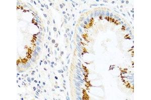 Immunohistochemistry of paraffin-embedded Human colon using FAM3B Polyclonal Antibody at dilution of 1:100 (40x lens). (FAM3B antibody)
