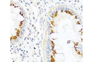 Immunohistochemistry of paraffin-embedded Human colon using FAM3B Polyclonal Antibody at dilution of 1:100 (40x lens).