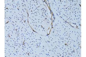 Immunohistochemistry of paraffin-embedded human uterus using SELE Antibody (ABIN5971217) at dilution of 1/100 (40x lens). (Selectin E/CD62e antibody)