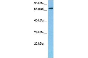 Host:  Mouse  Target Name:  DACH2  Sample Tissue:  Mouse Liver  Antibody Dilution:  1ug/ml (DACH2 antibody  (C-Term))
