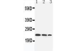 Anti-IL-10 antibody, Western blotting Lane 1: Recombinant Human IL-10 Protein 10ng Lane 2: Recombinant Human IL-10 Protein 5ng Lane 3: Recombinant Human IL-10 Protein 2.