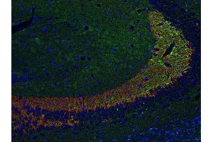 Indirect immunostaining of PFA fixed paraffin embedded mouse hippocampus section with anti-Synaptoporin (dilution 1 : 500; red) and chicken anti-Tau (, dilution 1 : 500; green). (Synaptoporin antibody  (C-Term))