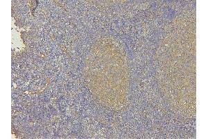 IHC analysis of EHD1 using anti-EHD1 antibody (ABIN6719599).