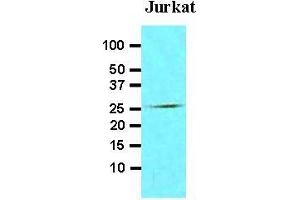 Cell lysates of Jurkat (30 ug) were resolved by SDS-PAGE, transferred to nitrocellulose membrane and probed with anti-human FADD (1:500). (FADD antibody  (AA 1-208))