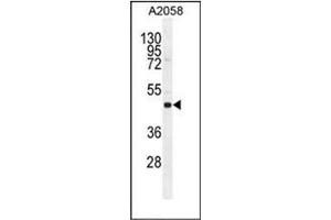 Western blot analysis in A2058 cell line lysates using SOCS4 Antibody  (35ug/lane). (SOCS4 antibody  (AA 234-262))