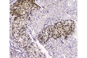 IHC analysis of CRM1 using anti-CRM1 antibody . (XPO1 antibody  (AA 966-1071))
