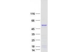 TWIST Neighbor Protein (TWISTNB) (Myc-DYKDDDDK Tag)