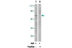 Western blot analysis of extracts from 293 cells, treated with EGF (200 ng/mL, 30 mins), using OPRM1 polyclonal antibody . (Mu Opioid Receptor 1 antibody)