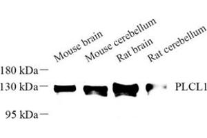 Western blot analysis of PLCL1 (ABIN7075067) at dilution of 1: 500 (PLCL1 antibody)