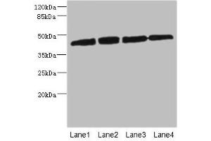 Western Blotting (WB) image for anti-Protein Kinase, CAMP-Dependent, Regulatory, Type I, beta (PRKAR1B) (AA 190-290), (Regulatory Subunit) antibody (ABIN7146618)