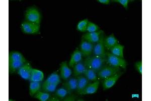 Immunofluorescence staining of Hela cells with ABIN7152261 at 1:50, counter-stained with DAPI. (EXOC8 antibody  (AA 508-725))
