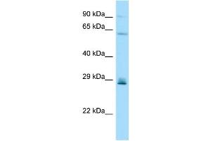 WB Suggested Anti-CD99L2 Antibody Titration: 1. (CD99L2 antibody  (Middle Region))