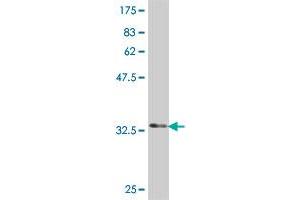 Western Blot detection against Immunogen (34. (MAGEA4 antibody  (AA 98-171))