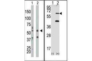 Image no. 1 for anti-Eukaryotic Translation Initiation Factor 2-alpha Kinase 2 (EIF2AK2) (N-Term) antibody (ABIN360663) (EIF2AK2 antibody  (N-Term))