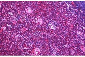 Human Thymus: Formalin-Fixed, Paraffin-Embedded (FFPE) (IGF2R antibody  (AA 2441-2490))