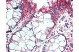 anti-PSPLA1 / Phospholipase A1 (AA 218-267) antibody