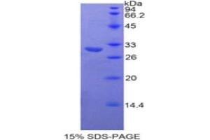 SDS-PAGE analysis of Human Neurofascin Protein. (NFASC Protein)