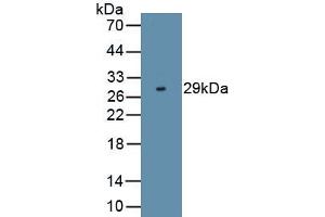 Detection of Recombinant GPX3, Rat using Polyclonal Antibody to N-Terminal Pro-Brain Natriuretic Peptide (NT-ProBNP) (NT-ProBNP antibody)