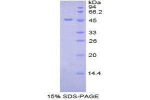 SDS-PAGE (SDS) image for Vitamin K-dependent protein C (PROC) (AA 53-445) protein (His tag) (ABIN2121953)
