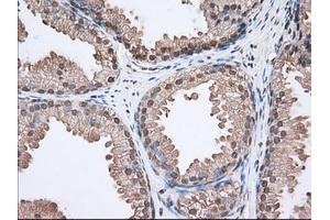 Immunohistochemical staining of paraffin-embedded Human lung tissue using anti-ACAT2 mouse monoclonal antibody. (ACAT2 antibody)