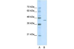 ZBTB26 antibody used at 0. (ZBTB26 antibody  (Middle Region))