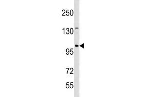 Western Blotting (WB) image for anti-Establishment of Cohesion 1 Homolog 1 (ESCO1) antibody (ABIN3004513) (ESCO1 antibody)