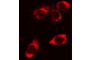 ABIN6266984 staining Hela cells by IF/ICC. (STARD13 antibody  (N-Term))