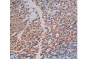 Immunohistochemistry (IHC) image for anti-Eukaryotic Translation Initiation Factor 2-alpha Kinase 2 (EIF2AK2) (AA 205-495) antibody (ABIN2117704)