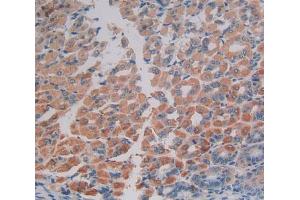 Used in DAB staining on fromalin fixed paraffin- embedded stomach tissue (EIF2AK2 antibody  (AA 205-495))