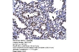 Human Lung (BARHL2 antibody  (Middle Region))