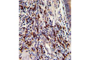 Immunohistochemistry (IHC) image for anti-CCR4-NOT Transcription Complex, Subunit 8 (CNOT8) antibody (ABIN3002662) (CNOT8 antibody)