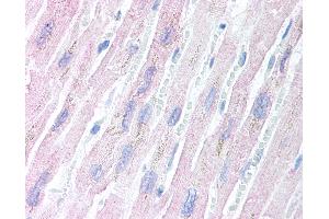 Anti-AES antibody IHC of human heart.