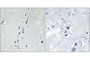 Immunohistochemistry analysis of paraffin-embedded human brain, using CaMK2 (Phospho-Thr286) Antibody. (CAMK2B antibody  (pThr286))