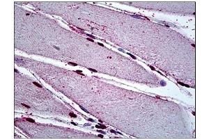 Immunohistochemistry (IHC) image for anti-Mesenchyme Homeobox 2 (MEOX2) antibody (ABIN781935) (MEOX2 antibody)