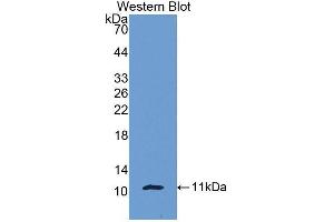 Western blot analysis of the recombinant protein. (beta-Thromboglobulin antibody  (AA 40-113))