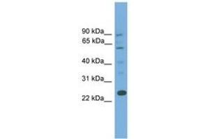Image no. 1 for anti-B-Cell CLL/lymphoma 7A (BCL7A) (AA 107-156) antibody (ABIN6745154) (BCL7A antibody  (AA 107-156))