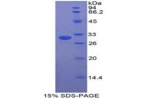 SDS-PAGE analysis of Human STAM Binding Protein.