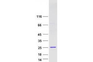Validation with Western Blot (IFNA10 Protein (Myc-DYKDDDDK Tag))