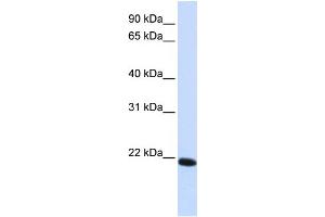 WB Suggested Anti-CLDN19 Antibody Titration:  0. (Claudin 19 antibody  (C-Term))