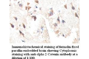 Image no. 1 for anti-Catenin (Cadherin-Associated Protein), alpha 2 (CTNNA2) antibody (ABIN791201) (CTNNA2 antibody)