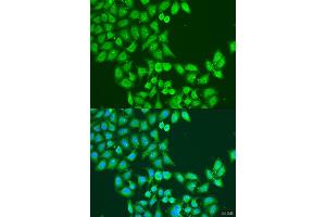 Immunofluorescence analysis of U2OS cells using STAT5A antibody (ABIN2737605) at dilution of 1:100. (STAT5A antibody)