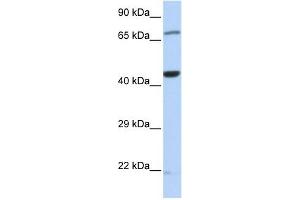 TUFM antibody used at 1 ug/ml to detect target protein. (TUFM antibody  (Middle Region))