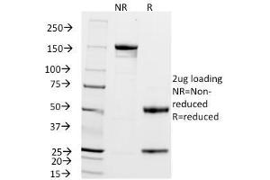 SDS-PAGE Analysis Purified ZAP70 Mouse Monoclonal Antibody (2F3. (ZAP70 antibody  (AA 1-254))
