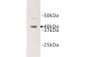 Western Blotting (WB) image for anti-Interleukin 1 Receptor-Like 1 (IL1RL1) (Extracellular) antibody (ABIN1854924) (IL1RL1 antibody  (Extracellular))