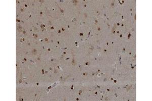 ABIN6266498 at 1/200 staining human brain tissue sections by IHC-P. (NOL3 antibody  (C-Term))
