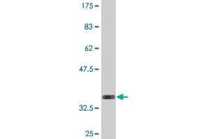 Western Blot detection against Immunogen (34. (WTAP antibody  (AA 70-151))